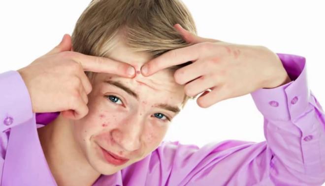 ok fazla ykamak var olan koruyucu bariyeri bozarak cilde zarar verir. Kesinlikle sivilceyi skmak, oynamak nerilmez. Sklan aknede iltihap yaylabilir, kzarklk artabilecei gibi, iz kalma riski de artar. Baz akne tiplerinde ancak doktor gzetiminde akne lezyonlar boaltlabilir"