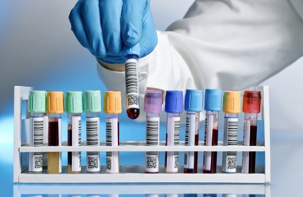 TESTLE ANLAILIR: Bir kiinin vcudunda serotonin eksikliini ancak laboratuvar testleriyle anlalabilir. Dolaysyla bu ikayetleri yaayanlarn mutlaka doktor kontrolnden gemeli. Eksik olan vitaminleri tespit ederek yerine koymak, doru beslenmeye ve spora yneltmek hastay olduka rahatlatacaktr" ifadelerini kulland.