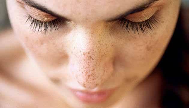 inde postasyum, magnezyum ve bakr gibi mineraller bulunan ayva, k aylarnda souk algnlna iyi gelirken ayn zaman da bilinmeyen bir ok faydas var. ifa kayna olan ayvann cilde faydalar saymakla bitmiyor.   <br>  Zararl gne nlar zamanla cilt zerinde lekeler brakr. Ayva ile yaplan maske de lekelerin azaltmasna yardmc oluyor.