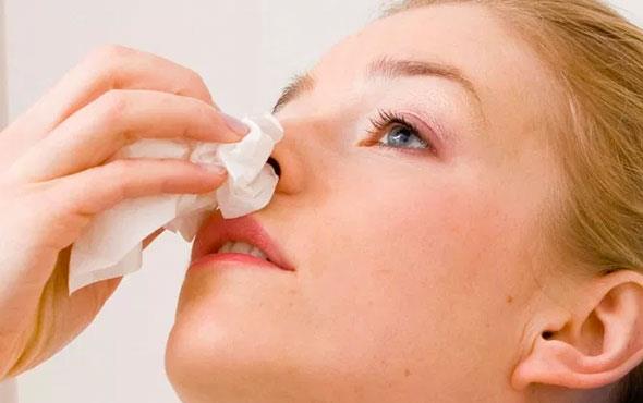 BURUN ET: Toplumda burun eti olarak bilinen konka adn verdiimiz burun iin yaplarn imesi de olduka sk rastlanan kronik burun tkankl sebeplerindendir. Kadnlarda adet dnemlerinde ve gebelikte yaanan hormonal deiimlerde burun etlerinin imesine yol aar. Kronik burun tkanklnn sebepleri arasnda srekli alerjiler de nemli bir yer tutmaktadr. zellikle alerjik zemine sahip hastalarda gelien polip gibi yaplar burnu tamamen tkayabilir.