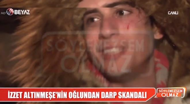 Grntlendiini fark eden Frat Altnmee, muhabirin kadna iddet uyguluyorsunuz demesinin ardndan "Ak olduum kadnla tartyorum" diyerek kendisini savunmaya alt. Bir sre muhabirle tartan Altnmee, Trk halkna ve kendisine kfrler savurdu.