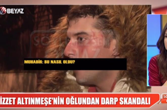 Frat Altnmee'nin yzndeki iziin ise kzn kendisini korumaya alt srada meydana geldii iddia edildi.