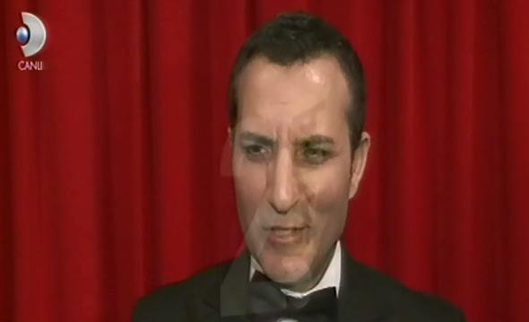 Rafet El Roman'n daha nce de yzne estetik mdahale yaptrd iddia edilmiti.