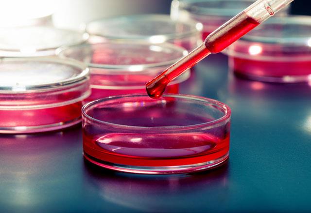 Berrin Pehlivan, ALL oluumunun kesin nedenlerinden bahsetmenin hala ok g olduunun altn izerek, unlar syledi; &#8220;Kaltsal ve kazanlan baz sebeplerle genler etkilenip olgunlamam kan hcreleri kontrolsz oalmaya balayabilirler.    Annenin hamilelii srasnda alt yer, kullanlan ila ve vitaminler, annenin sigara veya alkol kullanmas, herhangi bir kimyasala ya da radyasyona maruz kalmas ocukta lsemi gelime riskini arttrr. Erken dnemde tan hayat kurtarc olabilir.