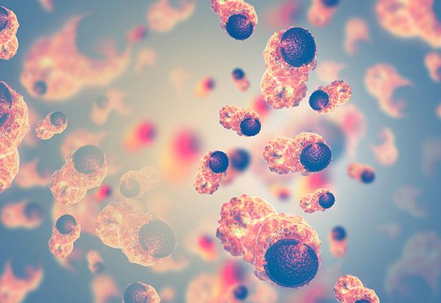 "Kaln barsak kanserinden korunmann dier bir yolu da dzenli kontrollerimizi yaptrmaktr. Hibir ikayeti olmayan bireylerde 45 yanda tarama balamal. Ailesinde kaln barsak kanseri olanlarda ise hastalk ortaya k yandan 10 yl nce tarama balamaldr" dedi.