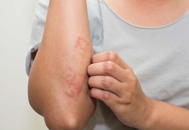 Bunlarn srrnn gen havuzumuzda ve genlerin rettii metabolitlerde olduunu dnyorum. Bu srlarn biri de vcudumuzun rettii palmitoleik asittir. Glgam Destan&#8217;nda aranan lmszln srrn tayan bitki belki de topraklarmzda bulunan ve palmitoleik asitten zengin olan idedir&#8221; diyerek almasna konu olan palmitoleik asidin nemini vurguluyor.