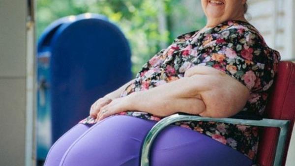 Ortaya kan bu sonular iin, cilt ve cilt altnda gelien deformasyona bal doku fazlasnn uzaklatrlmas ve karn duvarnn gl anatomik yapsnn yeni batan oluturulmas gerekir. Dnyada estetik amal yaplan ilk be ameliyattan birisi de karn germe operasyonudur.