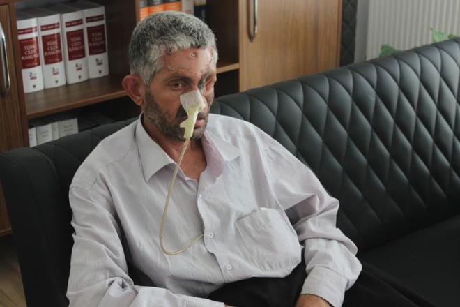 Bahekimin kendilerini hakl bulduunu syleyen avukat Graslan, &#8220;Mvekkilim ve ailesi doktor ve bahekimle grtler. Yalnz doktor tabi ki kendisinin hatas olduunu kabul etmiyor kesinlikle. Ama bahekim mvekkilimde herhangi bir daha ncesinde bir hastalk olduunda bu tetkiksiz yaplan ve tedavisiz yaplan di ekiminin o hastal tetiklemi olabileceini sylyor&#8221; dedi.