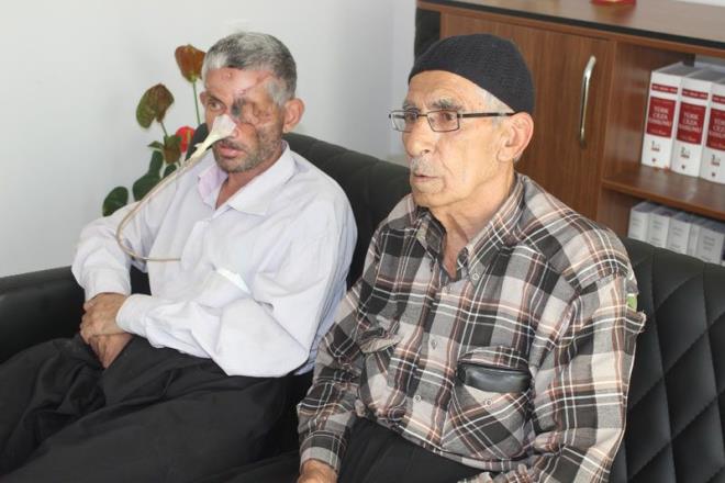 Olunun bu hale gelmesinden dolay dii eken hekimin sulu olduunu syleyen baba Bulat, &#8220;Herhalde ondan oldu baka bir eyden olmaz ki. ocuun hayatn karartt. Gz yok, yz yok. Paralad att. Onun iin verdik mahkemeye&#8221; dedi.