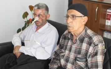 HATAY&#8217;da diini ektiren bir kiinin gzn kaybetti, yz kt, aile hukuk mcadelesi balatrken, sulanan di hekimi iddialar yalanlad.