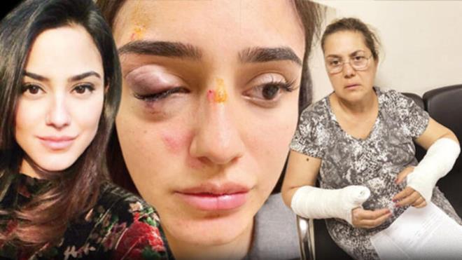 Ceren Kaplakarslan ile annesi sevgilisi tarafndan silahl ve tekmeli saldr sonucu hastanelik oldu. Gndemin st sralarna yerleen olay sonras Atilla Kaplakarslan dikkat eken aklamalar yapt. Baba Kaplakarslan'n aklamalarndan ne kanlar yle: