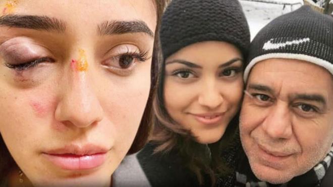 "Ayrlrsan anneni ve baban ldrrm"    Daha nceki iddetten haberimiz yoktu. Bu olay olunca rendik. Bu kii 'ben MT mensubuyum' diye ocuumu sindiriyor, eer benden ayrlrsan anneni ve baban ldrrm diye kandryor.