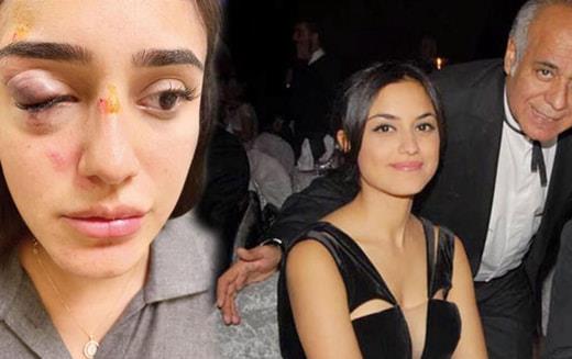 Sevgilisi Temel Kankran'n tabancann kabzasyla yzne vurup yerde tekmeledii 6 aylk hamile Ceren Kaplakarslan'n babas konutu. Baba Atilla Kaplakarslan Kanal D'de yaynlanan Mge ve Glen'le 2. Sayfa programnda verdii detaylar kan dondurdu.