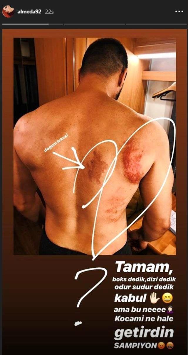 ampiyon iin boks dersleri almaya balayan Saymann, derslerde vcudunda ciddi yaralar olumutu. Einin vcudunda oluan morluklar gren Almeda Abazi ise "Tamam boks dedik, dizi dedik, odur budur udur dedik. Kabul! Ama bu ne? Kocam ne hale getirdin ampiyon!" diyerek sitemde bulunmutu.