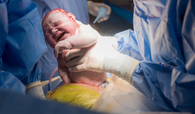 Yararl mikroptan yoksun braklan bebek, baklk sisteminde gleniyor.