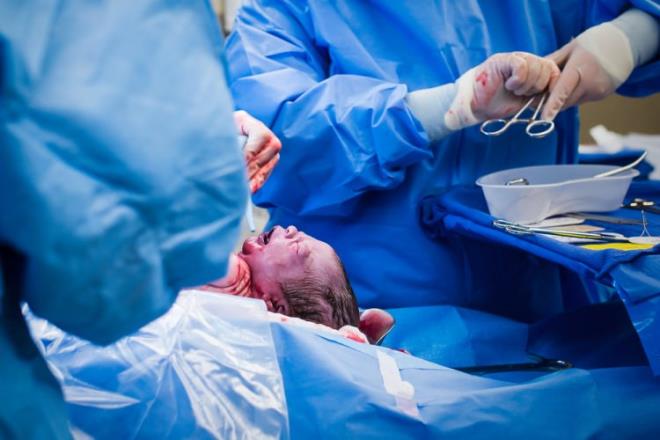 Sezaryen doumla bebek mikropsuz olan yerden karak hastane ortamnda kalyor.