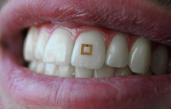 Karnzdaki kiinin diinin zerinde byle bir 'ey' grrseniz armayn. Bakn artk dilerde ne grmeye balyoruz?