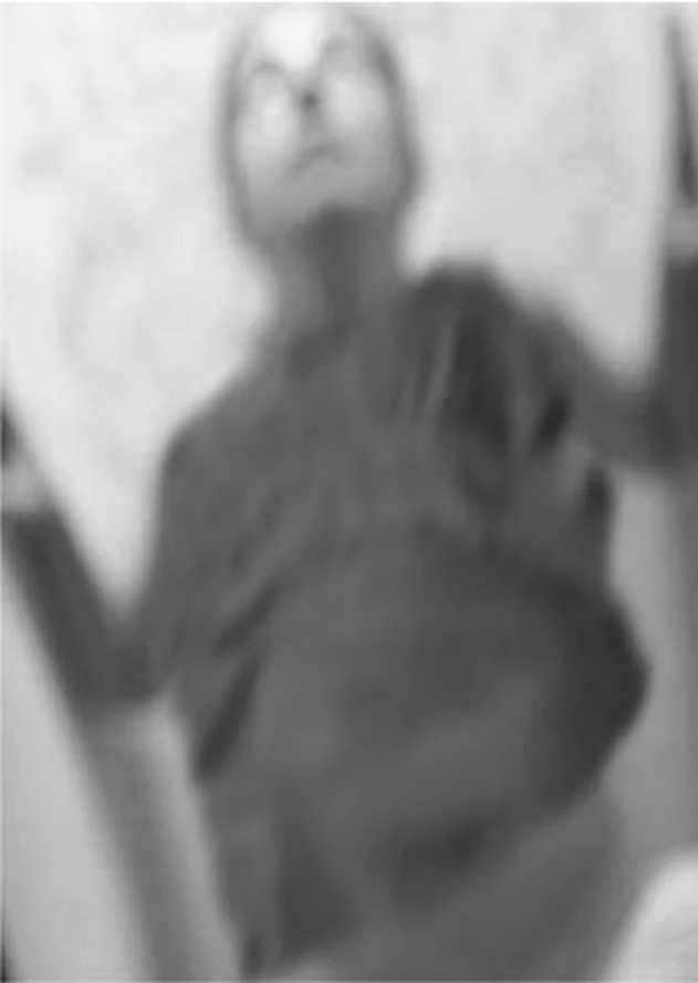 Madam Bobin 1901 ylnda Madam Bobin isimli kadn Senegal'den Fransa'ya gelmiti. Geldiinde sar humma hastalndan muzdaripti bu yzden hemen karantinaya alnd ve sonunda orada ld. Cansz bedeni solgun ve kaskat bir haldeydi ancak hemirelerden birisi bedeninin hala scak olduunu sylemiti. Hemire gen kadnn zamanndan nce ldne inanyordu.