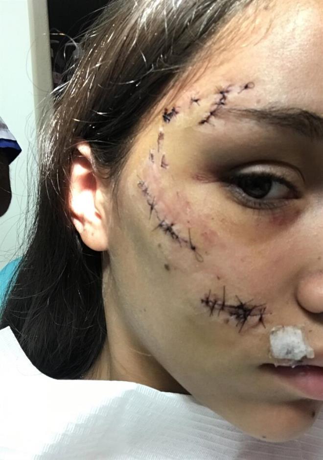 Cinsi ?Alman kurdu? olan kpek ile 2 fotoraf ektiren kz ardndan kpein saldrsna urad.