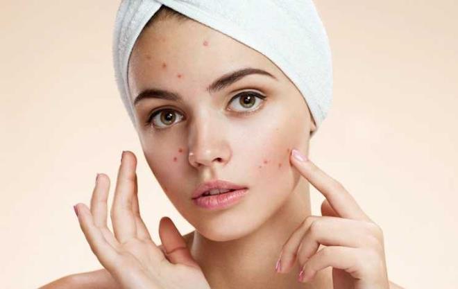 Dermatoloji Blm&#8217;nden Uzm. Dr. Fsun Bilgin Karahall, &#8220;Doutan olan benler konjenital nevs olarak adlandrlmaktadr. Konjenital benlerin 20 cm&#8217;den byklerine dev konjenital nevus ad verilmektedir ve doumsal benler arasnda sadece dev konjenital nevuslar tehlikelidir.&#8221; dedi.