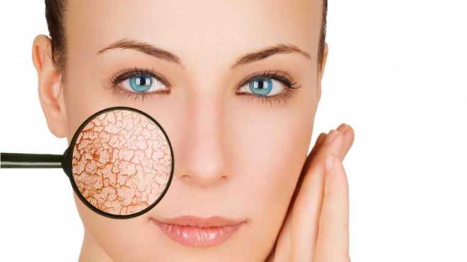 Genellikle aplar yaklak 1 cm&#8217;den daha byktr. Birka taneden fazla olabilmektedir. 30 yandan sonra kmaktadr. Aniden son zamanlarda bymesi, dzensizlemesi, bir kenarndan bymesi, renk deiiklii balamas, koyulamas, zerinde sznt, kanama, kabuklanma grlmesi tehlike arz etmektedir.