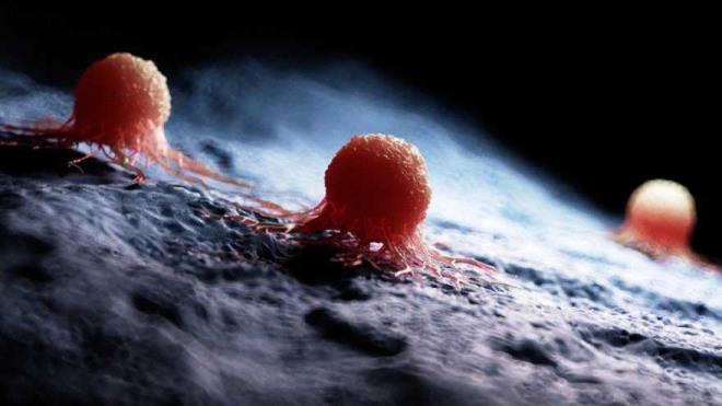 Karahall, &#8220;Benlerden risk tayanlar ise displastik nevs ad verilmektedir. Benlerin birok eidi bulunmaktadr, bu nedenle riskli olup olmadnn anlalmas iin dermatoloji uzman tarafndan dermatoskop ad verilen cihaz ile deerlendirilmesi gerekmektedir.&#8221; dedi.