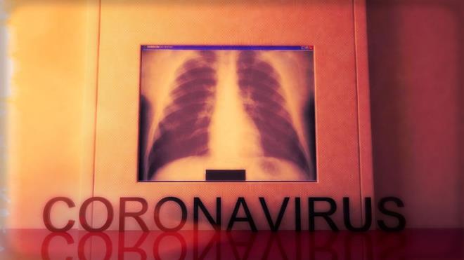 Hangi durumlarda COVID-19 enfeksiyonundan phelenilmeli?  <br>  Ate ve ani balangl solunum yolu hastal belirtileri (ksrk, solunum sknts vb.) bulunan kiilerde belirtilerin balamasndan nceki 14 gn iinde in&#8217;e ve hastalk yaylmnn devam ettii dier lkelere (ran, Singapur, Tayland, Japonya, Hong Kong, Gney Kore) seyahat yks var ise veya kantl/pheli COVID-19 hastas ile temas var ise hemen dier kiilerden ayr bir alana alnmal, maske kullanmas salanmal ve l Salk Mdrl ile iletiime geilmelidir. Salk Bakanl tarafndan hazrlanan ve pheli vaka tanm, sevk, bildirim ve ynetim algoritmalarn ieren COVID-19 Hastal Salk alanlar Rehberine alttaki linkten ulalabilir:<br>    https://hsgm.saglik.gov.tr/depo/birimler/Bulasici-hastaliklar-db/hastaliklar/2019_n_CoV/rehberler/COVID_19_RehberiV5_21Subat2020.pdf