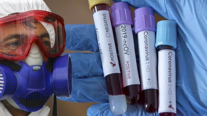 Koronavirs salgn dnyay sarsyor  <br>  in'in Wuhan kentinde balayan koronavirs (Covid-19) salgn tm dnyay etkisi altna ald. in'de 3245 kii hayatn kaybederken, salgnn yeni merkezi Avrupa'da talya lmlerle sarslyor. talya'da Corona virs nedeniyle son 24 saatte 427 kii hayatn kaybetti. lkedeki l says 3405'e karak salnn balad in'i geride brakt. Trkiye'de l says 4 olarak akland. Dnya ekonomisi neredeyse durma noktasna gelirken, sokaa kma yasaklar ya da insanlarn korunmak iin eve kapanmasyla dnya genelinde hayat neredeyse durma noktasna geldi.