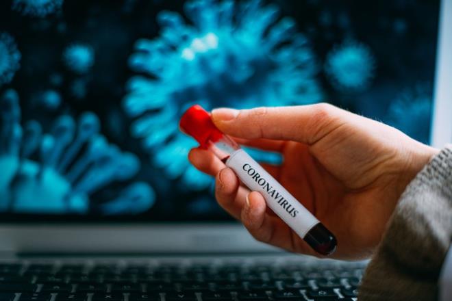  yerinde olas vak'aya durumunda yaplmas gerekenler ise u ekilde aktarld:    <br>&#8220; yerinde Covid-19 pozitif bir kii varl durumunda, l/le Salk Mdrl Bulac Hastalklar Birimine ivedilikle bilgi verilir. Maske takma kurallarna tam uyularak allan bir i yerinde, bir alann Covid-19 pozitif kmas durumunda etrafndaki kiiler yakn temasl kategorisinde deil, temasl kategorisinde deerlendirilir. Covid-19 pozitif kiinin takip ve tedavisi salk kuruluunca ynetilir, dier alanlar maskesini takarak almaya devam eder. l-ile Salk Mdrl tarafndan, hastalk belirtileri asndan 14 gn sreyle takip edilir&#8221;