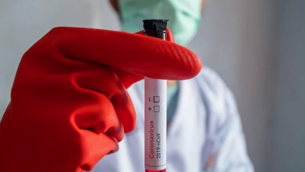 lm rakamlarnn arttn ama youn bakmdaki hasta saysnn biraz dmeye baladn belirten Prof. Dr. Mehmet z, yle konutu: Umarm nmzdeki haftalarda daha da dmeye balayacaz.