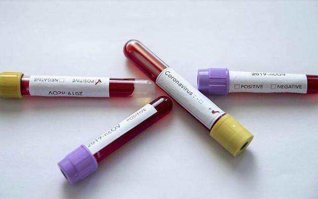 Bilim insanlar, testlere yzde 100 gvenilmemesi gerektiini; semptomlarn da dikkate alnmas gerektii konusunda uyarlarda bulundu.