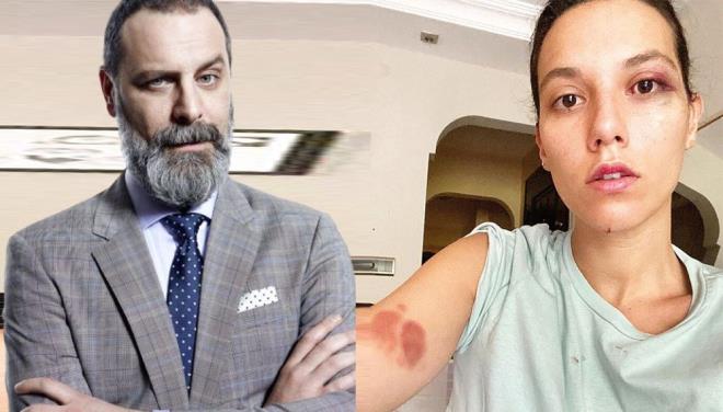 Deniz Bulutsuz, avukat araclyla stanbul Cumhuriyet Savcl&#8217;na verdii ikyet dilekesinde, Ozan Gven&#8217;in &#8216;kasten ldrmeye teebbs&#8217;, &#8216;hrriyetten yoksun brakma&#8217; ve &#8216;hakaret&#8217; sularndan yarglanmasn istedi.