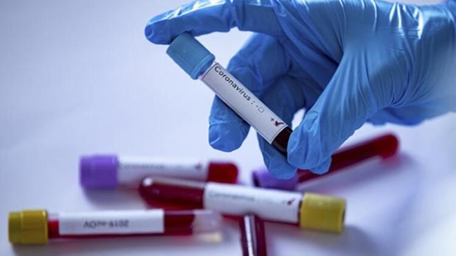 Bu rakamlara gre vaka art hz geen hafta, bir nceki haftaya gre yzde 7,7 azald.