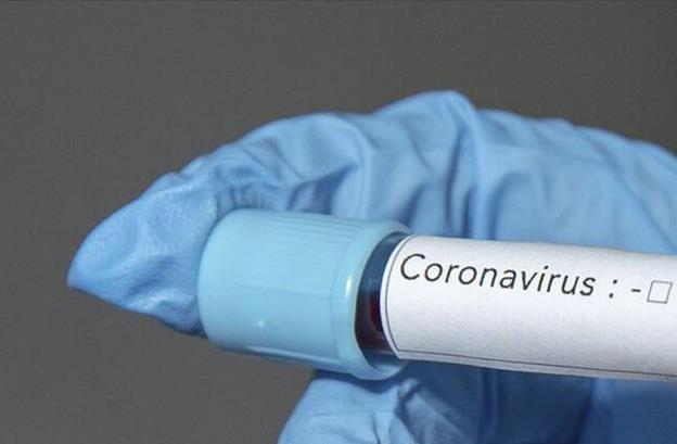 Aralk 2019'da in'in Hubei eyaletine bal Vuhan kentinde ortaya kan yeni tip koronavirs salgn (Kovid-19) nedeniyle dnya genelinde 836 binin zerinde insan hayatn kaybetti, 24 milyonu akn insan ise lmcl salgna yakaland. Koronavirs salgnna kar a ve ila gelitirme almalar devam ederken, salgnla ilgili yeni bir aratrma daha yapld. Aratrmann sonucunda uzmanlar, fark etmeden Kovid-19 geirmi olabileceinizi gsteren 7 iareti sralad.