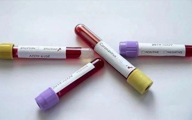 Fransa merkezli ila ve a devi Sanofi, uzun sredir Kovid-19 tedavisi iin denenen bir ilacn baarsz olduu bilgisini paylat.