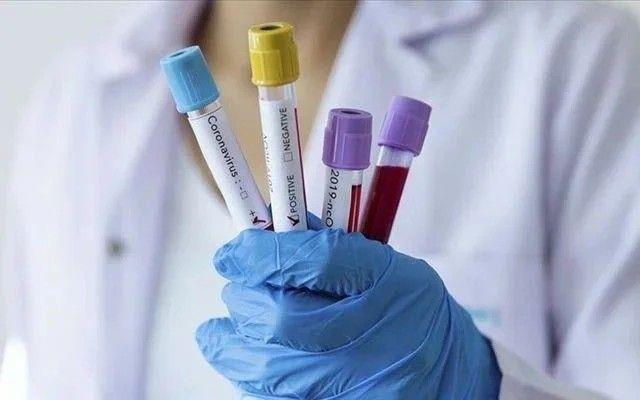 Regeneron'la beraber gelitirilen Kevzara iin yaplan testlerin baarsz olduu ve ilacn yeni testlere sokulmayaca aktarld.