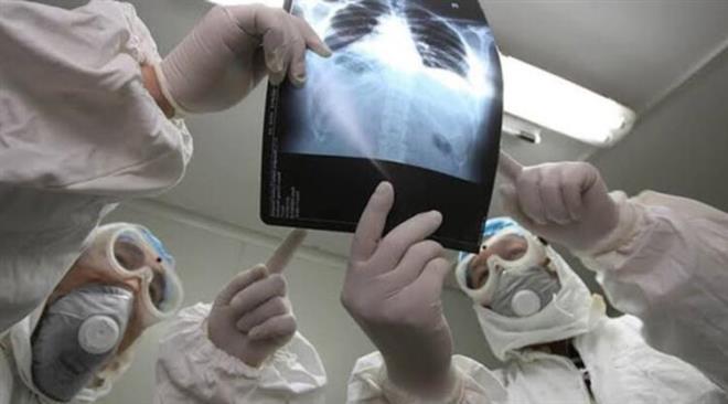 11. SOLUNUM SORUNLARI<br>  Koronavirs akcierlere saldrd iin, hastalarn solunum sorunlar yaama olasl olduka yksek. Ancak ou hasta iyiletikten sonra bile nefes almada glk ektii ikayetiyle doktorlarn kapsn alyor.