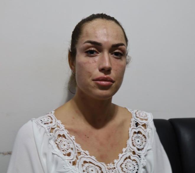 Bandan geen talihsiz olay DHA&#8217;ya anlatan alkan, &#8220;Yaz dneminde youn bir tempoda geirdim, cildimin yorulduunu dndm. zmir&#8217;de 2,5 hafta nce bir gzellik merkezine gittim. Cildimin nem kazanmas iin &#8216;genlik as&#8217; denilen bir ilem yapabileceklerini sylediler. Kabul ettim. Ama yan etkilerini hibir ekilde sylemediler. Astm hastas olduumu ve alerjimin olduunu belirtim. Ancak, sknt olmayacan sylediler. Genlik asn yaptrdm gnn gecesinde fenalatm, hastaneye kaldrldm&#8221; dedi.