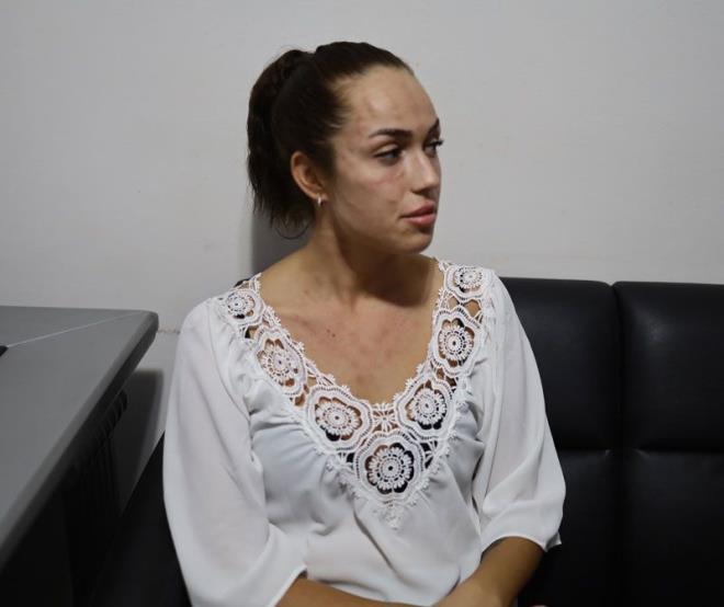 Uygulama sonrasnda yznn itiini ifade eden alkan, &#8220;Yzm komple iti, nefesim darald. Uzunca bir sre nefes alamadm. Tm gece hastanede kaldm. Sonrasnda ise doktor doktor gezdim. Halen de tedavi gryorum. Antibiyotik kullanp, kortizon alyorum. Doktorlar kontrol etti, boynumda kistler olduunu syledi. Bunlarn gemesinin aylar srebilecei veya hi gemeyebileceini belirttiler. Yaadklarmdan sonra su duyurusunda bulunduk. Avukatm konuyu takip ediyor&#8221; diye konutu.