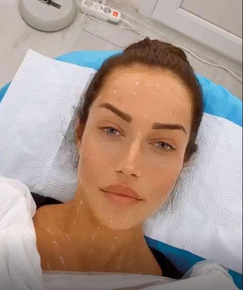 "Yaplan ey estetik mdahaledir"<br>    Yaanan skntnn yaplan uygulamadan kaynaklanm olabileceinin altn izen Delihdrlgil, "ok da genlik asndan olabileceini dnmyorum akas, ancak unu da ifade etmek istiyorum ki; bu uygulama cildin aydnlanmasn ve toparlanmasn salayacak olan, vcutta eksik olan enzimlerin, proteinlerin, serumla cilt altna mezoterapi uygulamasdr. 15- 20 dakika sryor, ine ile enjekte ediliyor. Bunun gzellik merkezi deil, bir klinikte uygulanmas gerekir. nk yaplan bir estetik mdahaledir. Ayrca, uygulamada kullanlacak olan ilalar kiinin de grmesi ve ona gre karar vermesi gerekiyor&#8221; diye konutu.