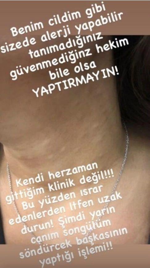 Akaln, ''Tanmadnz, gvenmediiniz, hekim bile olsa yaptrmayn! Israr edenlerden ltfen uzak durun!'' uyarsn yapmadan da gemedi.