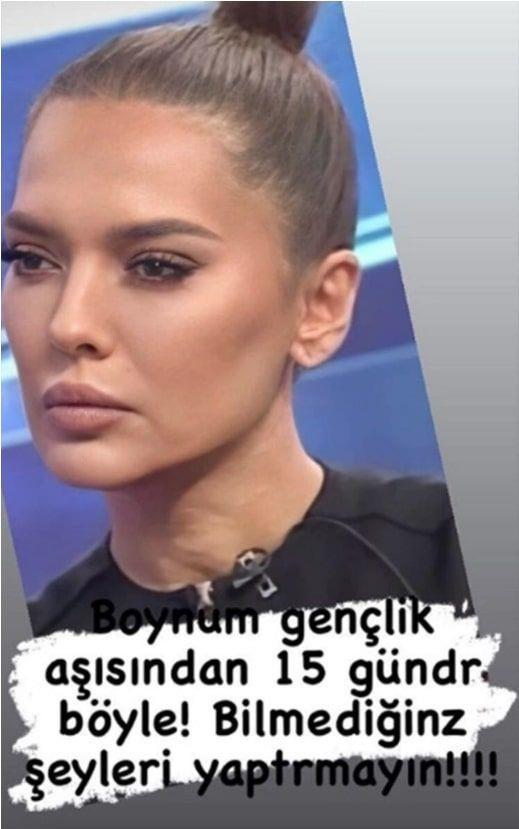 Demet Akaln, fotorafn paylaarak, 'Boynum genlik as yznden 15 gndr byle! Bilmediiniz eyleri yaptrmayn!'' dedi.