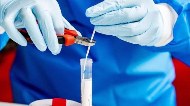 Ann farkl ya gruplarna farkl koruma dzeyleri salayp salamayaca sorusunun yantnn  hafta iinde belli olacan ifade eden ahin, farkl etnik gruplar zerinde farkl etki gsterip gstermeyeceinin de henz netlik kazanmadn sylyor. ahin, ann er hafta arayla koldan iki doz halinde yaplacan ve bylece en az bir yllk koruma salayacan kaydediyor.