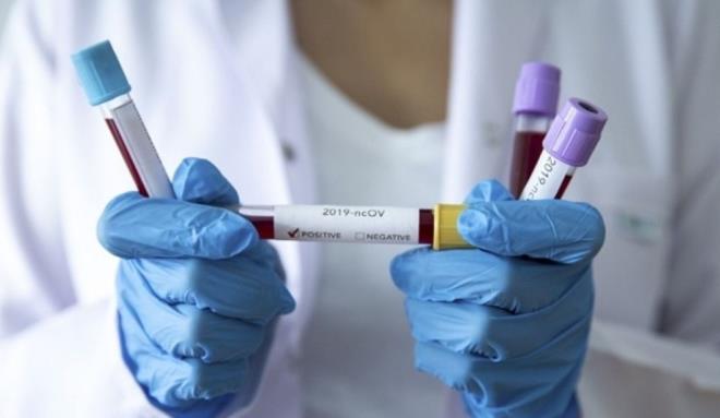 9. gn<br>  Tm belirtiler iddetle artar.  Yz veya dudaklarda mavileme grlr.  ksrk ve balgam ok iddetlenir.  Vcut ve ba arlaryla birlikte kusma ok iddetli bir hale gelir.  Bu belirtilere sahipseniz hemen tbbi yardm aln.