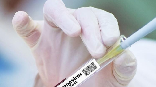 Toplumlarda alama orannn 50-60 civarnda olduu hesaba katldnda zorunlu olmad srece, a fazlas doabilecek.