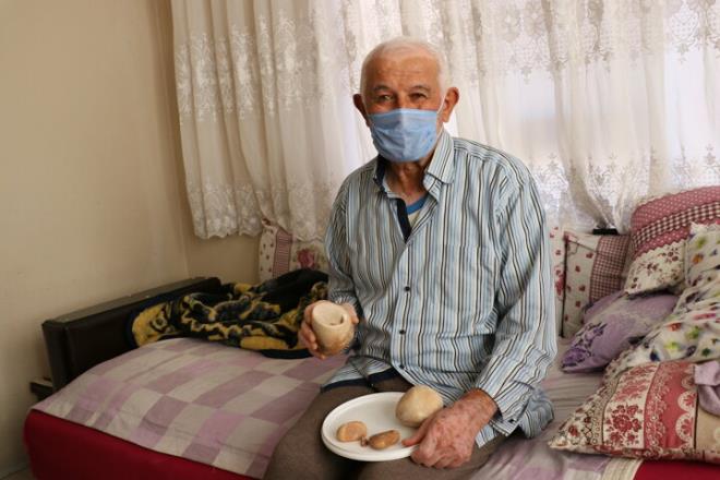 Prof. Dr. Zmrtba ise 18 yllk meslek hayatnda bu kadar byk mesane ta grmediini belirtti.