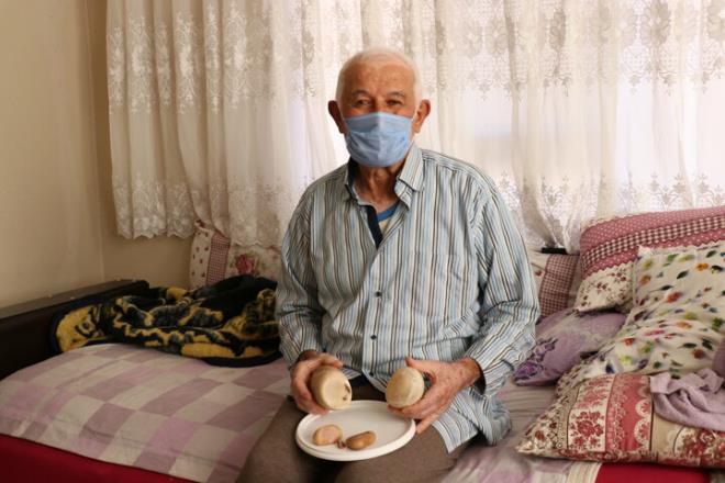 Denizli'de 73 yandaki hasta mesanesinden kartlan 2 kilogram ta hatra olarak saklayacak