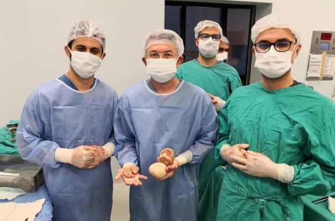 Cerrahi Tp Bilimleri Blm retim yesi Prof. Dr. Ali Ersin Zmrtba tarafndan muayene edilen Kul'un yapay mesanesinde ok sayda ta tespit edildi.