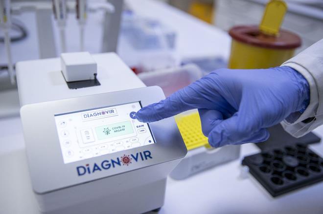 "Halihazrda orofarenks ve nazofarenks gibi derin blgelerden srnt rnei almak yerine, az iinden tkrk rnei alnmas da sistemin kullanmn tercih edilir klyor. Yaygn olarak kullanlan PCR testlerinden farkl olarak, sistem rnek oaltmaya deil, gelimi optik yntemlerle virsn varl ya da yokluunun tespitine dayanyor."