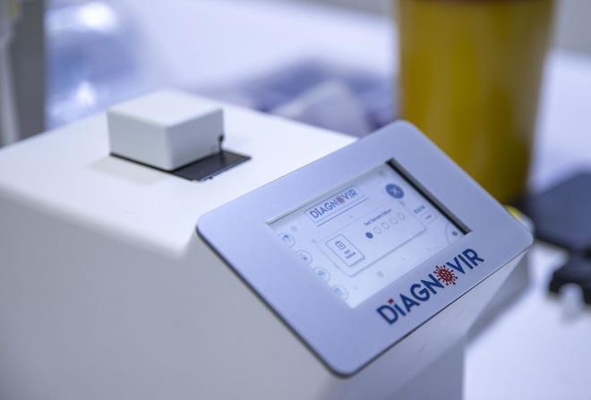 Hzl ve gvenilir bir virs tespit yntemi olarak, sistemin Trkiye'de ve dnyada yaygn olarak kullanlacana inandklarn dile getiren Orta, "Bu biyosensr sisteminin seri retimi iin gerekli altyap yatrmlarna halihazrda baland. Etik Kurul onay ve Trkiye la ve Tbbi Cihaz Kurumu (TTCK) onay gibi gerekli izinlerin en ksa srede tamamlanarak, rnn seri retim safhasna geilmesi ve tahminen 2 ay ierisinde kullanclarla buluturulmas planlanyor. Bu sayede pandeminin kontrol altna alnmasna katkda bulunulacak ve sosyal hayatn nemli lde rahatlatlmas mmkn olacak." deerlendirmesinde bulundu.